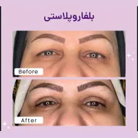 کلینیک پوست و مو|خدمات آرایشگری و زیبایی|تهران, خانی آباد نو شمالی|دیوار