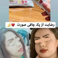 پک چاقی صورت * تضمینی*|آرایشی، بهداشتی، درمانی|قم, شهید رجایی|دیوار
