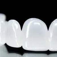 ویزیتور لابراتوار دندانسازی