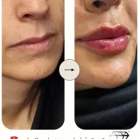 ارائه انواع خدمات زیبای درمطب توسط پزشک|خدمات آرایشگری و زیبایی|قم, امامزاده ابراهیم|دیوار