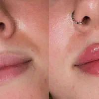 خدمات فیلر بوتاکس و روشن سازی واژن توسط پزشک