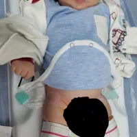 ختنه،جراحی سرپایی شرق|خدمات آرایشگری و زیبایی|دماوند, دماوند|دیوار