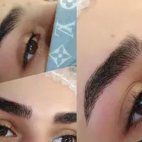 فیبروز ابرو