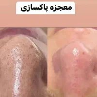 پاکسازی و فیشال پوست|خدمات آرایشگری و زیبایی|میبد, |دیوار