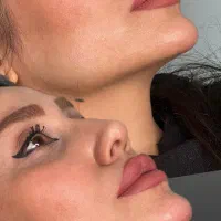ارائه خدمات زیبایی بوتاکس و فیلر