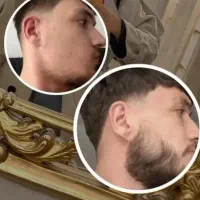 رویش ریش و موی سر کاملا تضمین 100 درصد ساخت آلمان