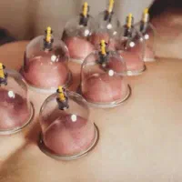 حجامت مطمئن و بهداشتی در منزل (با پرستار باتجربه)