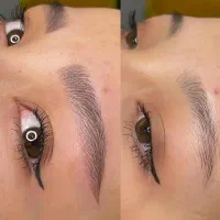 جذب مدل میکروبلیدینگ