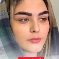 تزریق فیلر بوتاکس نخ لیفت بلفاروپلاستی توسط پزشک|خدمات آرایشگری و زیبایی|تبریز, |دیوار
