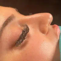 عمل بینی اقساطی|خدمات آرایشگری و زیبایی|تهران, الهیه|دیوار