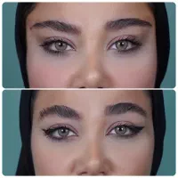 تزریق ژل لب بوتاکس مزو نخ آنزیم لیفت پکیج۱۰ سی سی|خدمات آرایشگری و زیبایی|تهران, مرزداران|دیوار