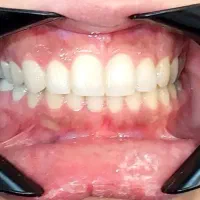 ارتودنسی فقط با۵ تومن