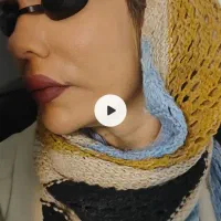 برداشتن خال کک مک منگوله گوشتی لک در یک جلسه ژل|خدمات آرایشگری و زیبایی|گلستان (تهران), |دیوار