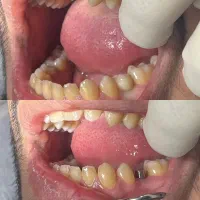 ایمپلنت دیجیتال|خدمات آرایشگری و زیبایی|قم, نیروگاه|دیوار