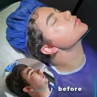 بلفارو غبغب فیلربادی لیفت بینی شقیقه ابرو نخ لاغری