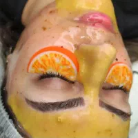 خدمات تتو برداشتن خال و لک فشیال موخوره گیری