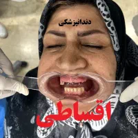 کلینیک دندانپزشکی قسطی بدون پیش پرداخت تمامی خدمات