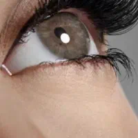 فرصتی ویژه برای کاشت مژه