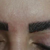 خدمات پاکسازی پوست