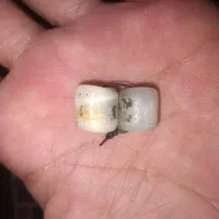 مهره
