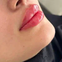 فیلر لب وبوتاکس|خدمات آرایشگری و زیبایی|مشهد, هفت تیر (آب و برق)|دیوار