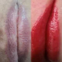 درمان ابروهای تاتو دار بدون نیاز به لیزر وریموو|خدمات آرایشگری و زیبایی|بهبهان, |دیوار