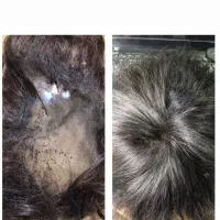 ترمیم موی ریخته و پارگی پروتز