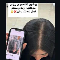 ریزش مو|آرایشی، بهداشتی، درمانی|تهران, راه آهن|دیوار