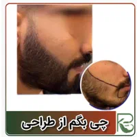 کاشت مو ابرو ریش تارکوب|خدمات آرایشگری و زیبایی|ورامین, |دیوار