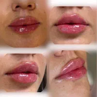 زیبایی طبیعی ، جوانی و تناسب اندام