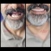 مرکز تخصصی دندانسازی اسپی دنتال|خدمات آرایشگری و زیبایی|خرمآباد, |دیوار