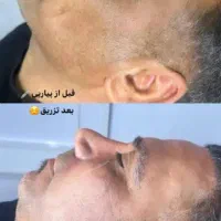 ژل بدن وصورت آموزش  تزریق دراهواز|خدمات آرایشگری و زیبایی|اهواز, کیانپارس |دیوار