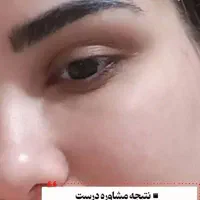 پووست موو|آرایشی، بهداشتی، درمانی|چیتاب, |دیوار