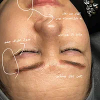 جشنواره تخفیفی فیشال تخصصی صورت|خدمات آرایشگری و زیبایی|مشهد, هفده شهریور|دیوار