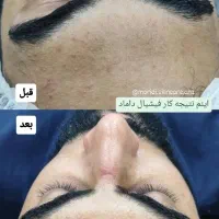 پاکسازی و فیشیال تخصصی در اهواز|خدمات آرایشگری و زیبایی|اهواز, بهارستان|دیوار