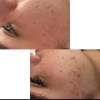 فشیال وپاکسازی تخصصی|خدمات آرایشگری و زیبایی|نورآباد ممسنی, |دیوار