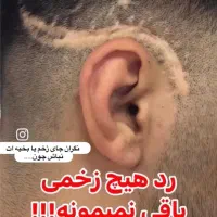 میکرو اسکالپ سر|خدمات آرایشگری و زیبایی|شهریار, شهرک وائین|دیوار