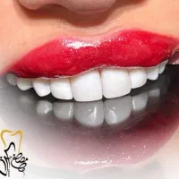 دندانپزشکی اقساطی دکتر مصطفی چگینی