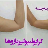 آب درمانی لاغری نمک درمانی درد مفاصل|خدمات آرایشگری و زیبایی|قم, قلعه یزدیها|دیوار