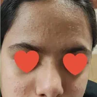 ورکشاپ تخصصی پوست (پاکسازی)