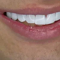 جشنواره دندانپزشکی زیبایی و درمانی
