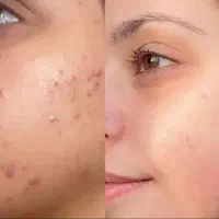 فیشیال تخصصی