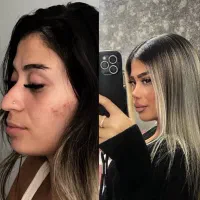 جراحی زیبایی صورت و بدن