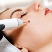 برداشتن خال.سوراخ کردن گوش