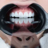 دندانپزشکی با تخفیف ویژه به مدت ۲ هفته