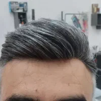 پروتز موی طبیعی