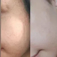 پاکسازی پوست فروش محصولات آرایشی و بهداشتی صورت...|خدمات آرایشگری و زیبایی|گلبهار, |دیوار
