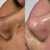 پوست|خدمات آرایشگری و زیبایی|نی‌ریز, |دیوار