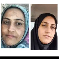 لک هارو تضمینی محو کن