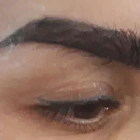 بلک فرایدی تخفیف استثنایی غبغب تزریق چربی فیلر|خدمات آرایشگری و زیبایی|تهران, دارآباد|دیوار